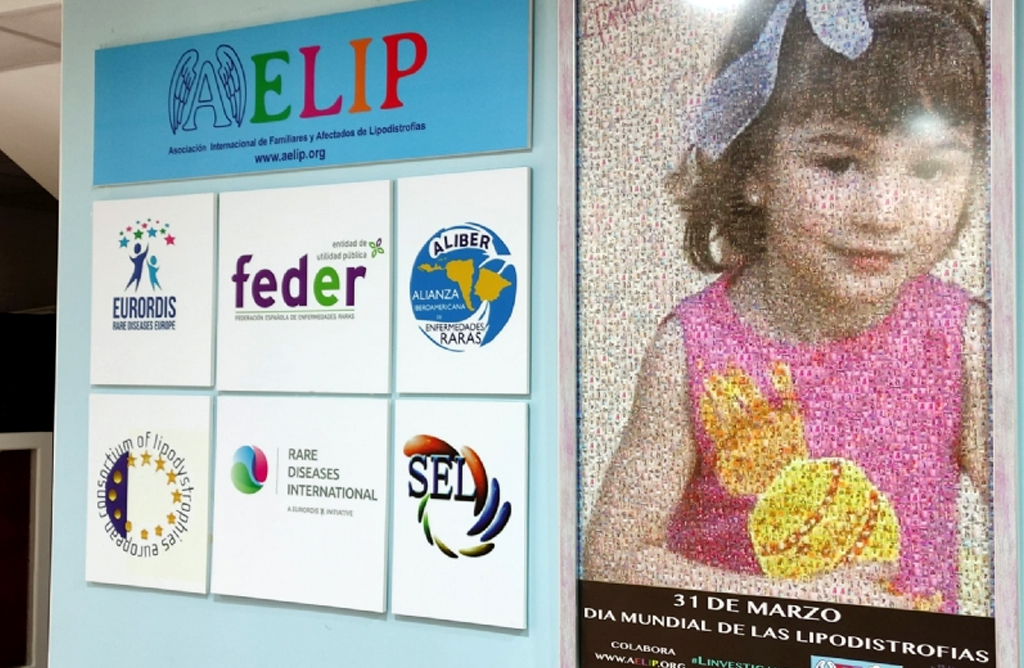 Totana se sumará al Manifiesto del Día Mundial de las Lipodistrofias